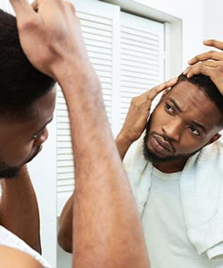 Male Baldness Pattern at REVAMP Wellness Center for Men in Jacksonville, FL